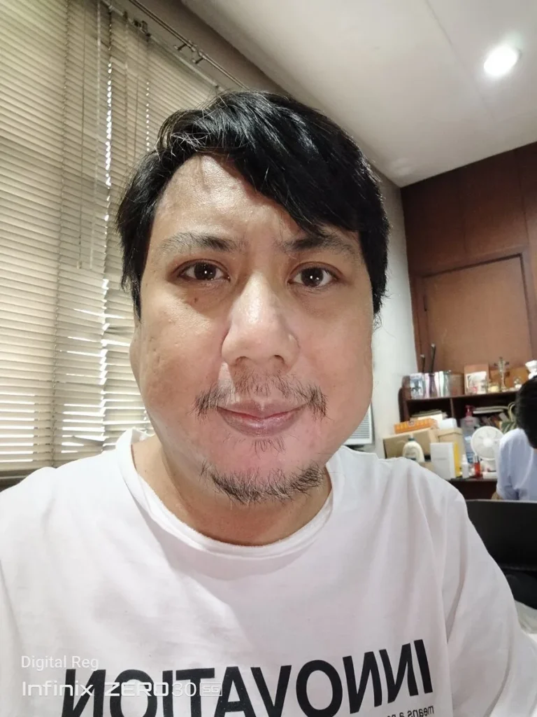Infinix Zero 30 5g Sample Photos 11