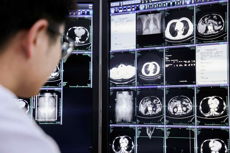 Alibaba Photo 1 Doctor At A Hospital In Lishui City Of China's Zhejiang Province Examines A Ct Scan